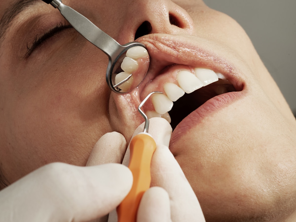 Teeth Whitening treatment inspiration